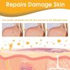 Ximonth Beesvenom Wart Care Spray, Improves Flesh Particle Mole Repair Smooth Skin Wart Treatment Spray