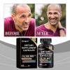 Googeer Dietary Supplement Capsules, Dietary Supplement Capsules For Body Treatment