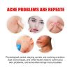 Jaysuing Cloud Acne Patch, Invisible Blemish Patch Gently Repair Acne Muscle To Reduce Acne Marks