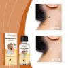 South Moon Skin Care Agent, Smooth Body Skin Repair, Dilute Meat Granules Moisturizing And Moisturizing Care