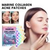 EELHOE Marine Collage Nacne Patches, Facial Acne Cleanser Multi-Shape Portable Acne Patch