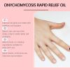 Ouhoe Gray Nail Repair Lotion Foot Care Moisturizing Cleaning Anti-Barb Gray Nail Repair Lotion