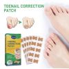 Jaysuing Toenail Furrow Correction, Toenail Insert Nail Repair Correction Pull-up Nail Nail Patch
