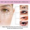 OUHOE Retinol Eye Stick, Dilute Fine Lines Eye Black Rim Of The Eye Skin Moisturizing Firming Eye Cream