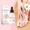 Ouhoe Gray Nail Repair Lotion Foot Care Moisturizing Cleaning Anti-Barb Gray Nail Repair Lotion