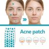 West&Month Hydrocolloidal Acne Patch, Repair Acne Acne Cleansing Invisible Breathable Waterproof Acne Cleansing Concealer