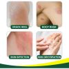 South Moon Herbal Tinea Corproris Cream, Mild Non-Irritating Ointment For Itch Relief External Ointment For The Body