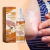 Ximonth Moss Care Spray Repair Skin Moss Moisturizing Skin Anti-Itch Treatment Topical Spray