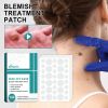 Ximonth Blemish Treatment Patch, Fade Face Flesh Nevus Cure Warts Clean Body Smooth Skin Repair Corns Cure Warts Patch