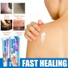 Jaysuing Warts Cream, Repair Skin Granules Gram Wart Body Care Topical Cream