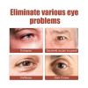 Jaysuing Eye Care Eye Cream, Reduces Fine Lines, Bags And Dark Circles, Skin Around Eyes Moisturizes And Tightens Cream
