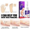 South Moon Remove Chicken Eye Lotion Extra Clear Remove Corns Skin Care Chicken Calluses Foot Pad Gram Warts
